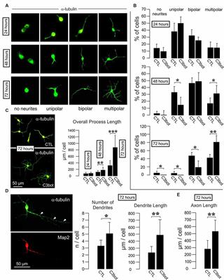 The Higher Sensitivity of GABAergic Compared to Glutamatergic Neurons to Growth-Promoting C3bot Treatment Is Mediated by Vimentin
